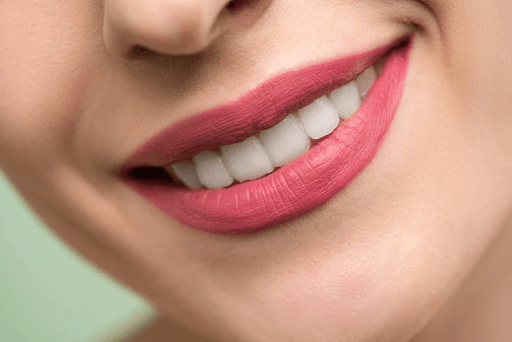białe zdrowe zęby po zabiegu wybielania